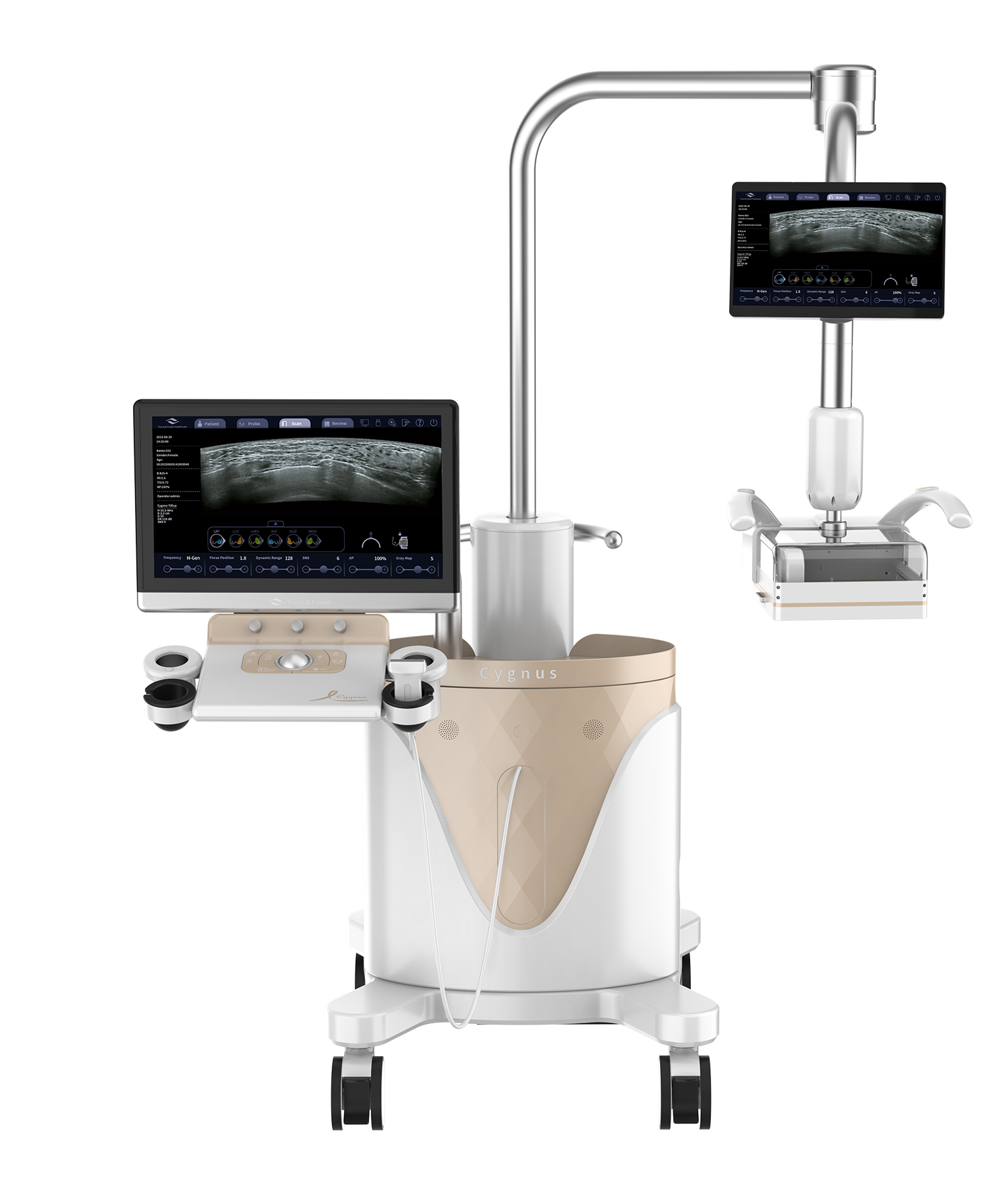 Cygnus 70_1 Sistema Ultrasonido Mamario 3D Cygnus 70 - Imagen 1