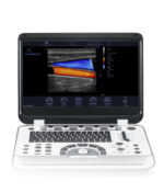 Ecógrafo Portátil FINUS 70 - Imagen 5